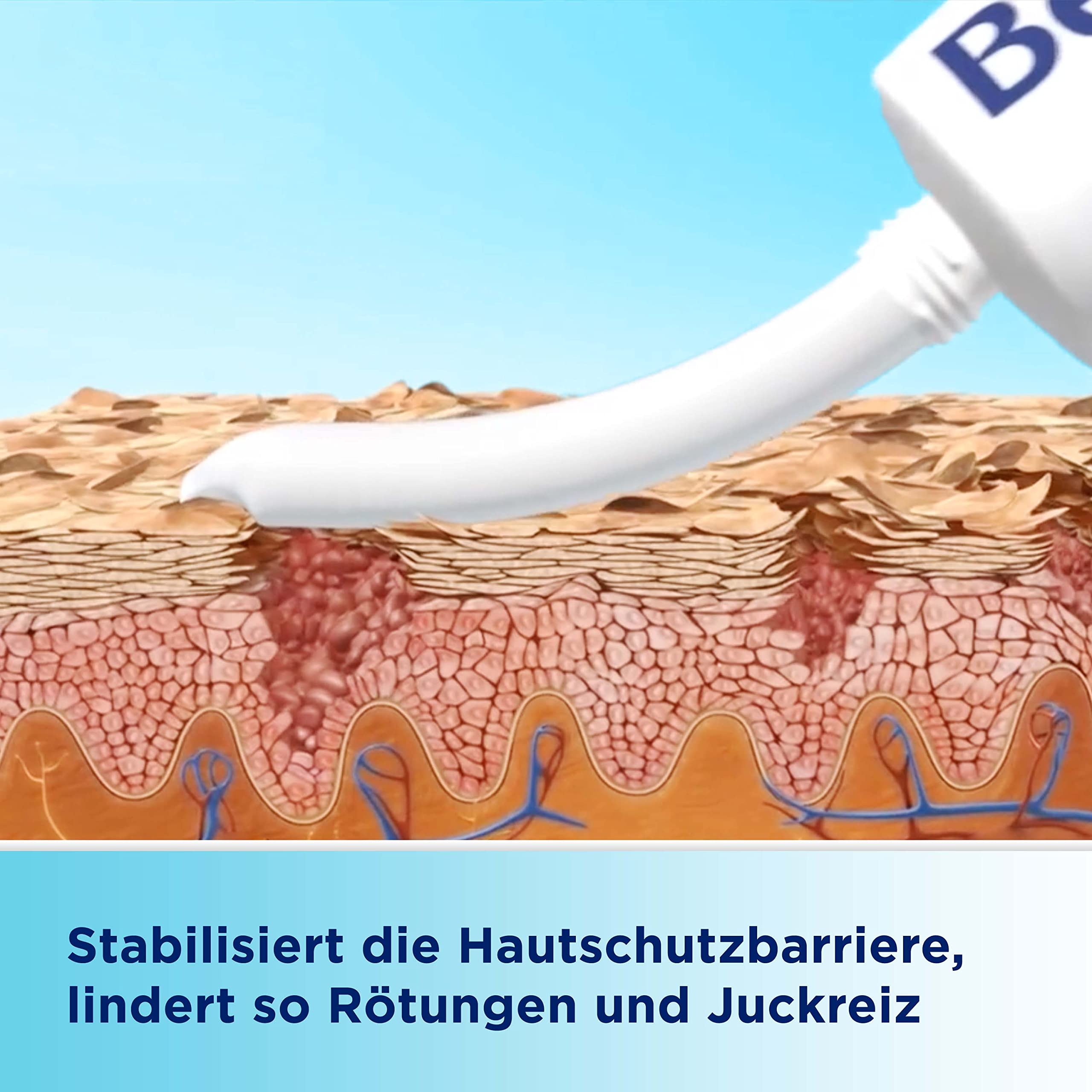 bepanthen-sensiderm-creme-20g-kortisonfrei-bei-juckreiz-und-r-tungen image 2