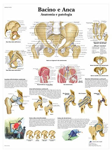 3b-scientific-vr4172l-poster-becken-und-h-fte-anatomie-und-pathologie image 4