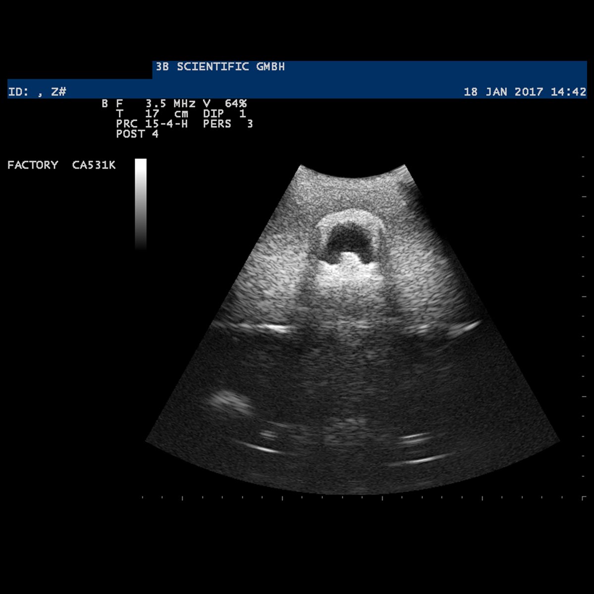 3b-scientific-p120-sonotrain-ultraschall-venenmodell-venen-trainer-f-r-ultrascha image 8