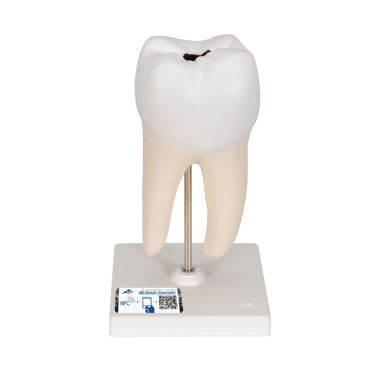 3b-scientific-unterer-molar-2-wurzelig-zahnmodell-mit-karies-2-teilig-app image 1