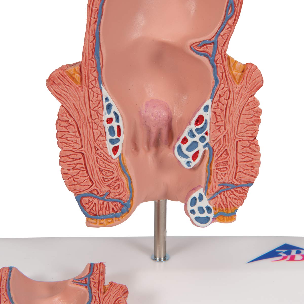 3b-scientific-h-morrhoidenmodell-enddarm-frontalschnitt-3b-smart-anatomy-app image 8