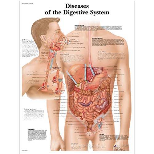 3b-scientific-krankheiten-des-verdauungssystems-laminierte-pathologie-lehrtafel- image 2
