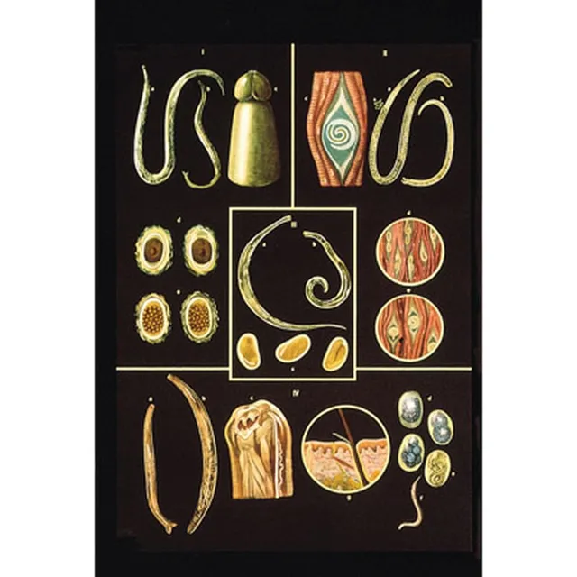 3b-scientific-lehrtafel-darmparasiten-ii-anatomie-wandkarte-84x200-cm-mit-holzbe image 1