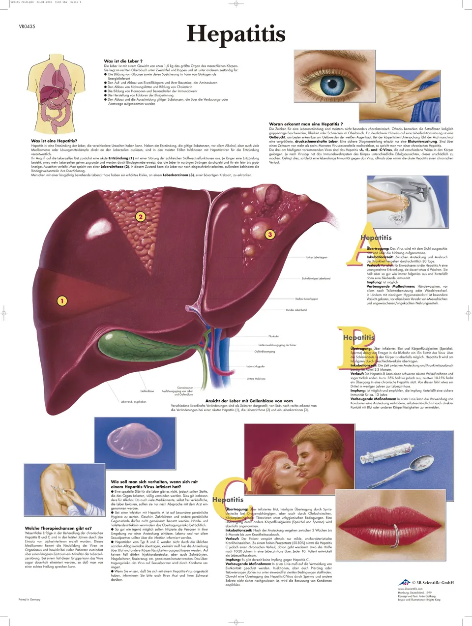 3b-scientific-lehrtafel-hepatitis-laminiert-anatomie-poster-50-x-67-cm image 1