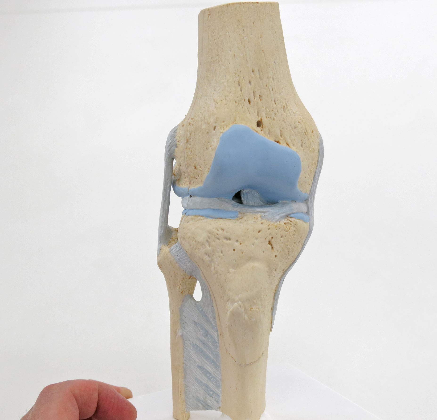 3b-scientific-gelenkschnitt-modell-knie-3-teilig-kniegelenk-schnittmodell image 5