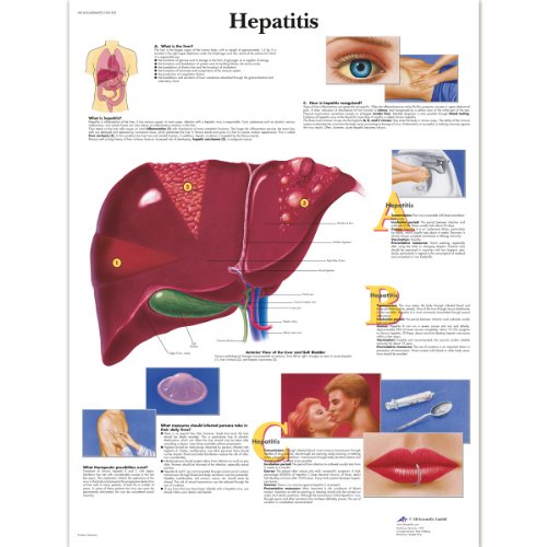 3b-scientific-human-anatomy-hepatitis-lehrtafel-papier-50-x-67-cm image 4