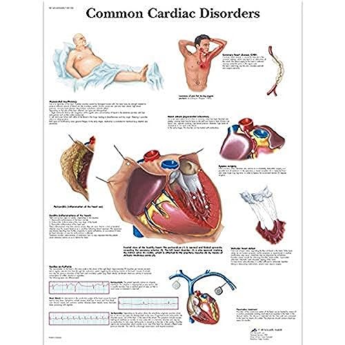 3b-scientific-lehrposter-h-ufige-herzerkrankungen-diagramm-poster-50-x-67-cm image 3
