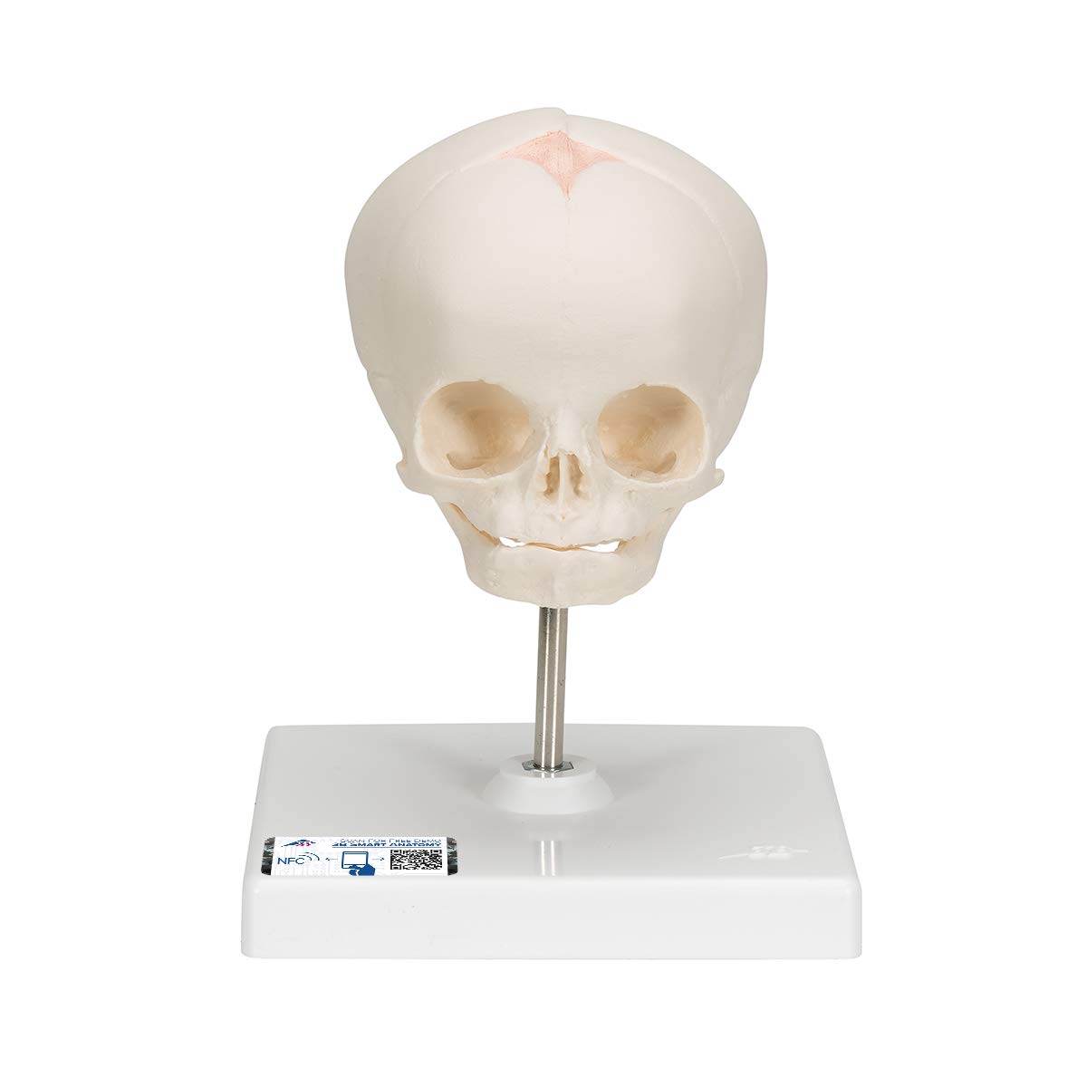 3b-scientific-f-tus-sch-del-naturabguss-30-ssw-auf-stativ image 1