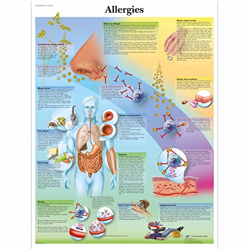 3b-scientific-lehrtafel-allergien-laminiertes-anatomie-poster-50-x-67-cm image 4