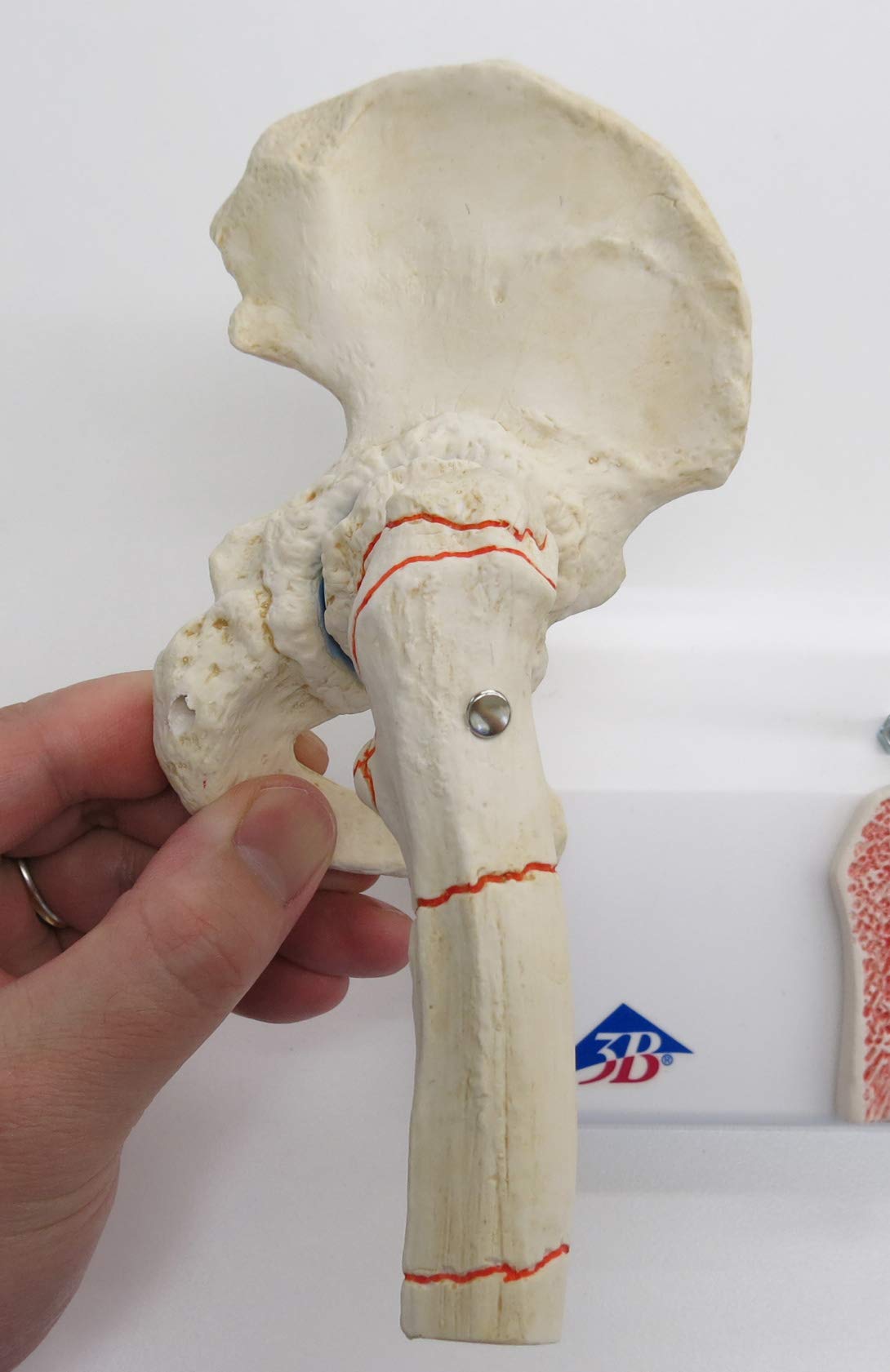 3b-scientific-h-ftgelenkmodell-mit-oberschenkelbruch-und-arthrose-pvc image 7