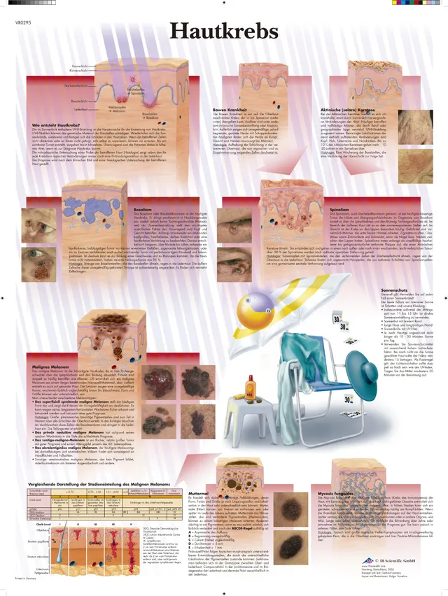 3b-scientific-lehrtafel-hautkrebs-laminiertes-anatomie-poster-50-x-67-cm image 1
