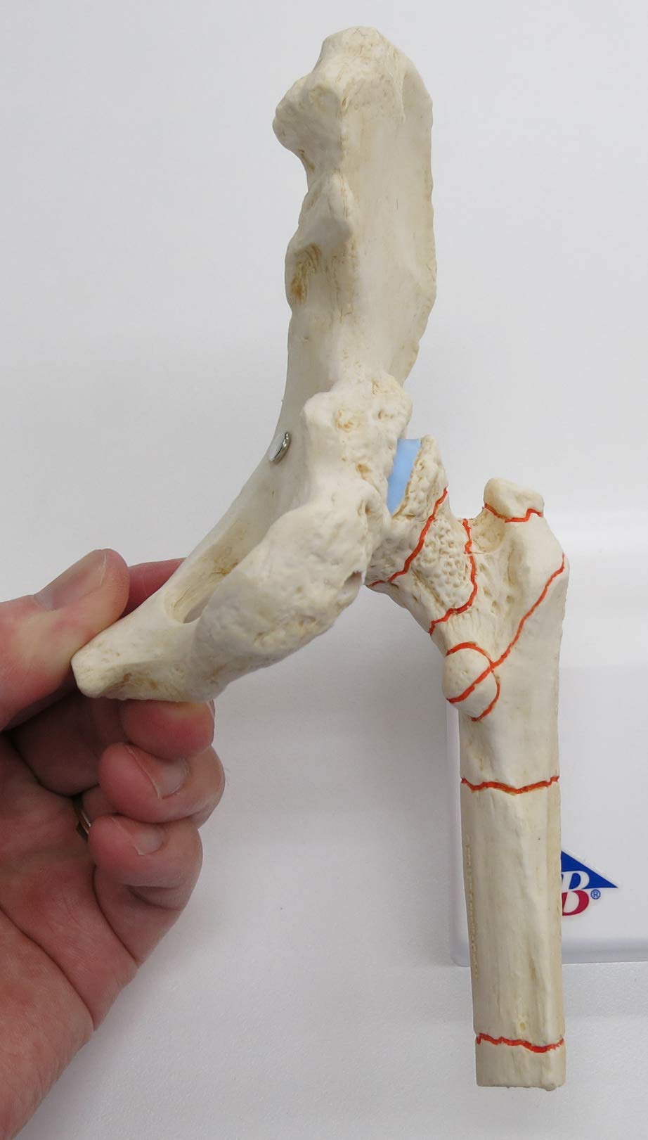 3b-scientific-h-ftgelenkmodell-mit-oberschenkelbruch-und-arthrose-pvc image 6