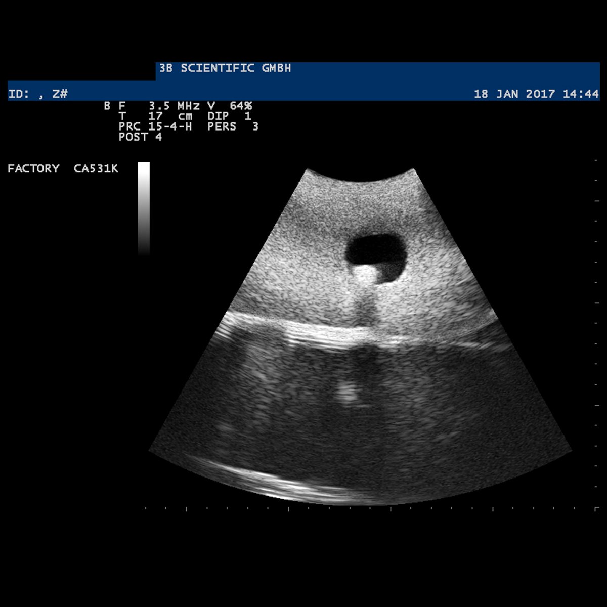 3b-scientific-p120-sonotrain-ultraschall-venenmodell-venen-trainer-f-r-ultrascha image 7