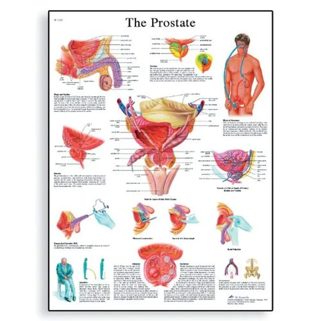 3b-scientific-lehrtafel-the-prostate-gland-englisch-poster-50x67-cm image 1