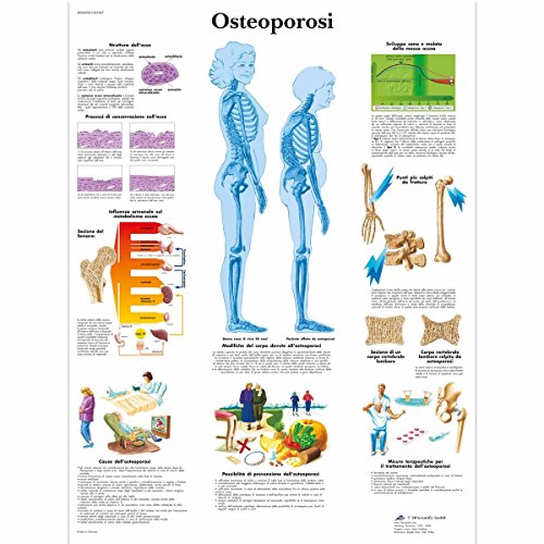 3b-scientific-anatomie-poster-osteoporose-vr4121l-medizinische-lehrtafel image 3
