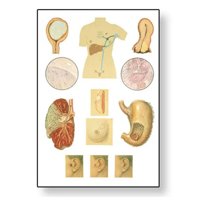 3b-scientific-lehrtafel-krebs-anatomie-wandkarte-84x200-cm-mit-holzbest-bung image 1