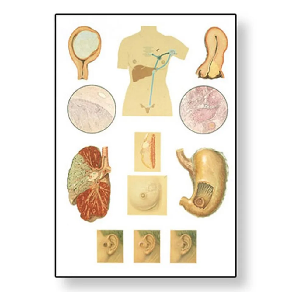 3b-scientific-lehrtafel-krebs-anatomie-wandkarte-84x200-cm-mit-holzbest-bung image 1