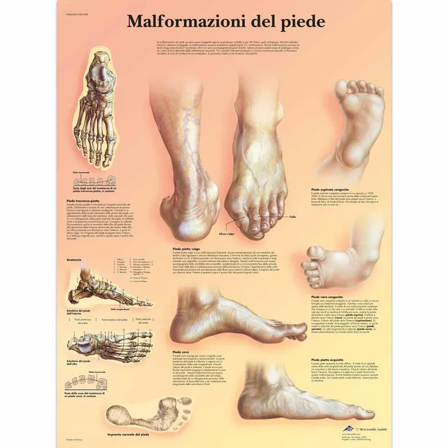 3b-scientific-lehrtafel-missbildungen-des-fu-es-vr4185l-anatomie-poster image 1