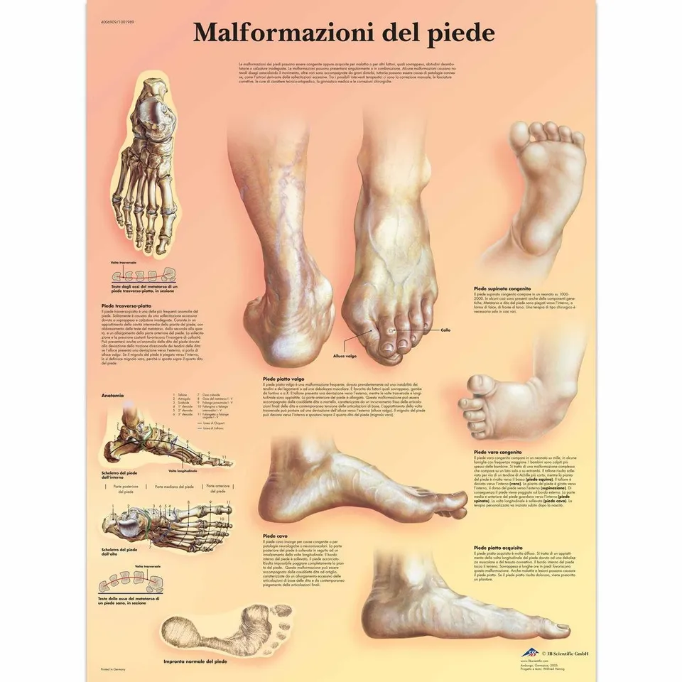 3b-scientific-lehrtafel-missbildungen-des-fu-es-vr4185l-anatomie-poster image 1