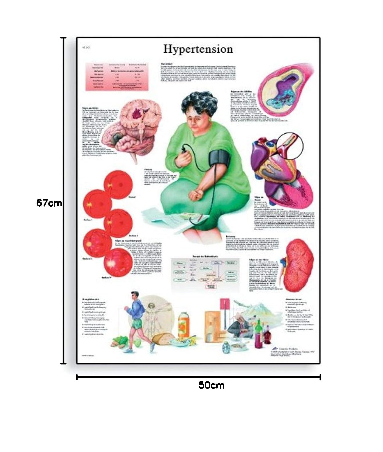 3b-scientific-hypertonie-diagramm-papier-50-x-67-cm-anatomie-lehrtafel-bluthochd image 2
