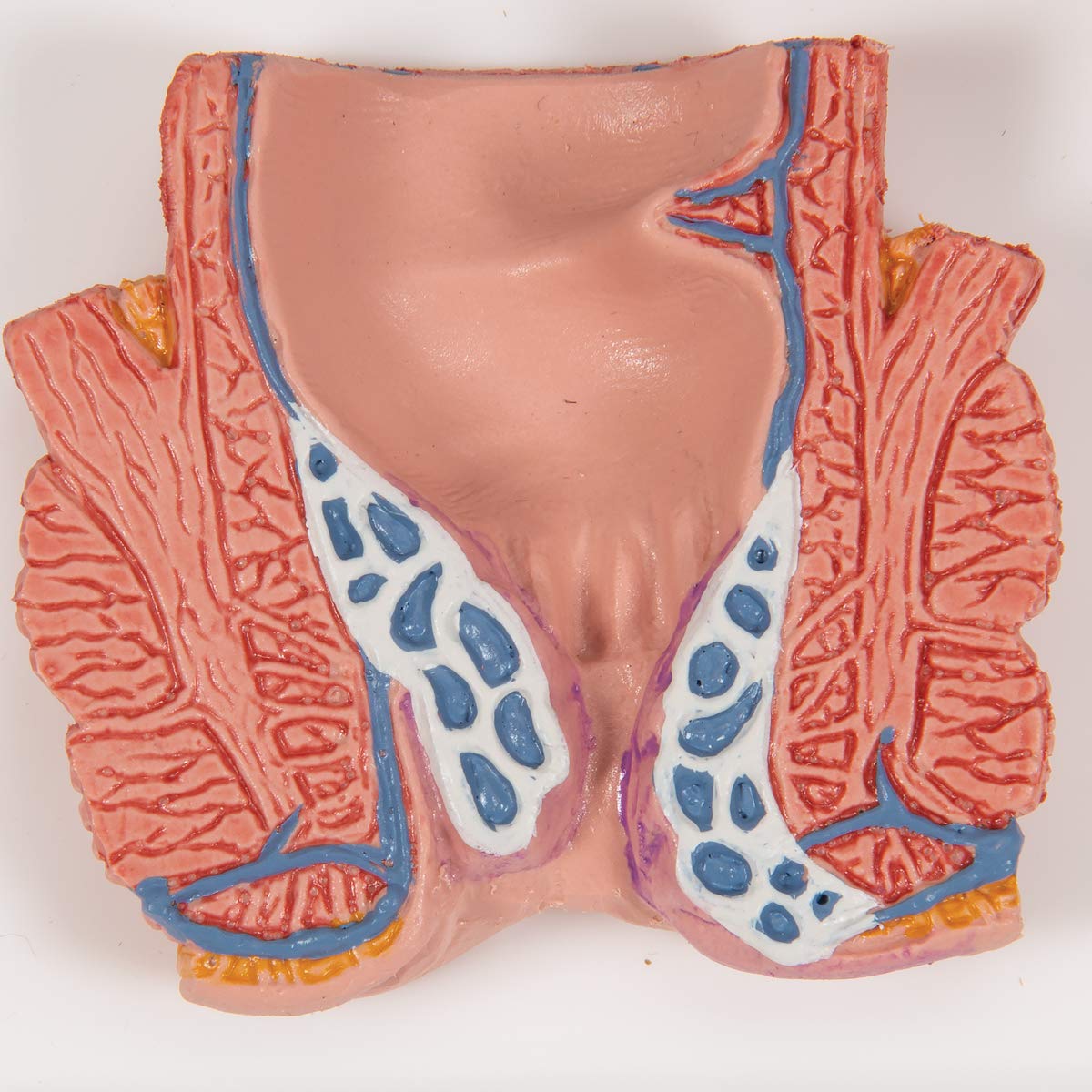 3b-scientific-h-morrhoidenmodell-enddarm-frontalschnitt-3b-smart-anatomy-app image 7