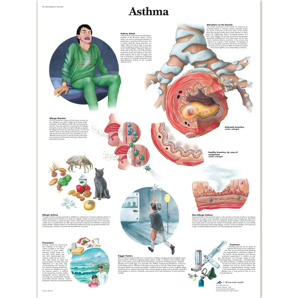 3b-scientific-asthma-laminierte-anatomie-lehrtafel-pathologieposter-50-x-67-cm image 1
