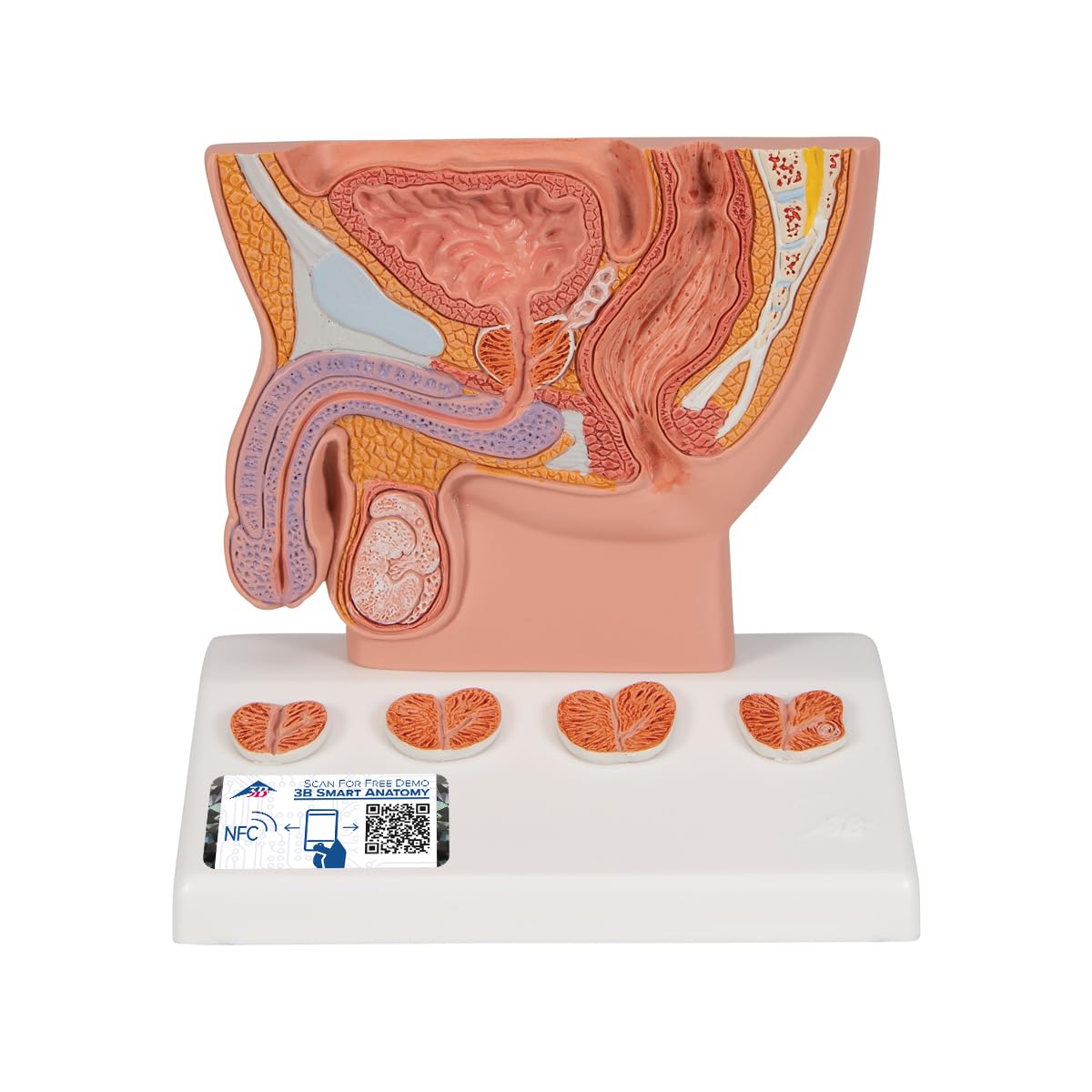 3b-scientific-prostata-modell-halbe-gr-e-auf-sockel-3b-smart-anatomy-app image 1