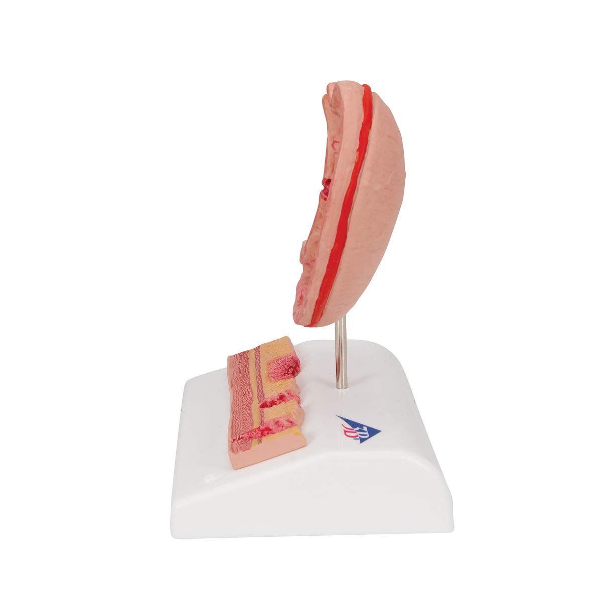 3b-scientific-magenmodell-mit-geschw-ren-humananatomie-modell-aus-pvc-smart-anat image 3