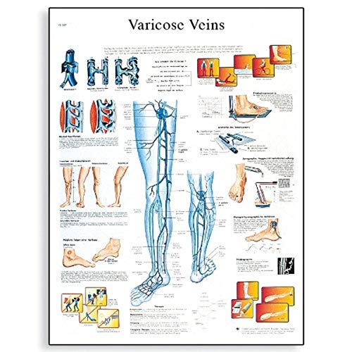 3b-scientific-lehrtafel-varicose-veins-englisch-laminiert-50-x-67-cm image 4