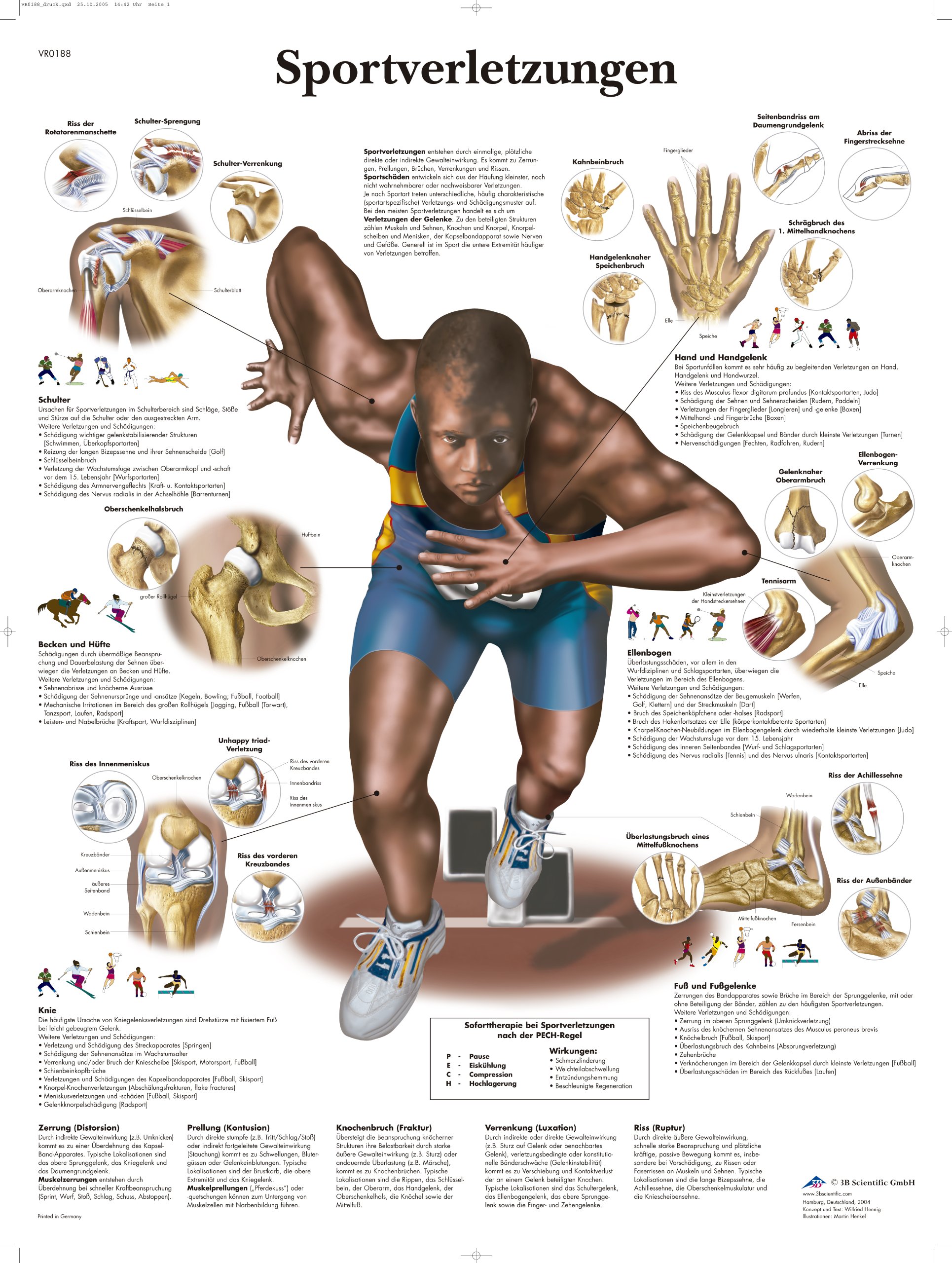 3b-scientific-lehrtafel-sportverletzungen-vr0188uu-50-x-67-cm image 1