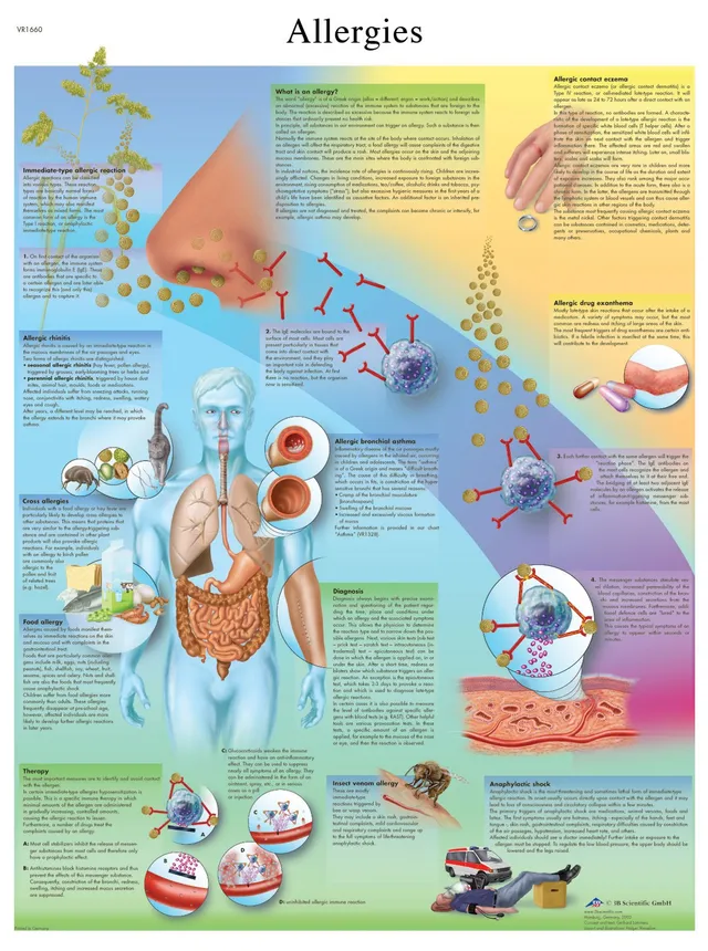 3b-scientific-lehrtafel-allergien-laminiertes-anatomie-poster-50-x-67-cm image 1