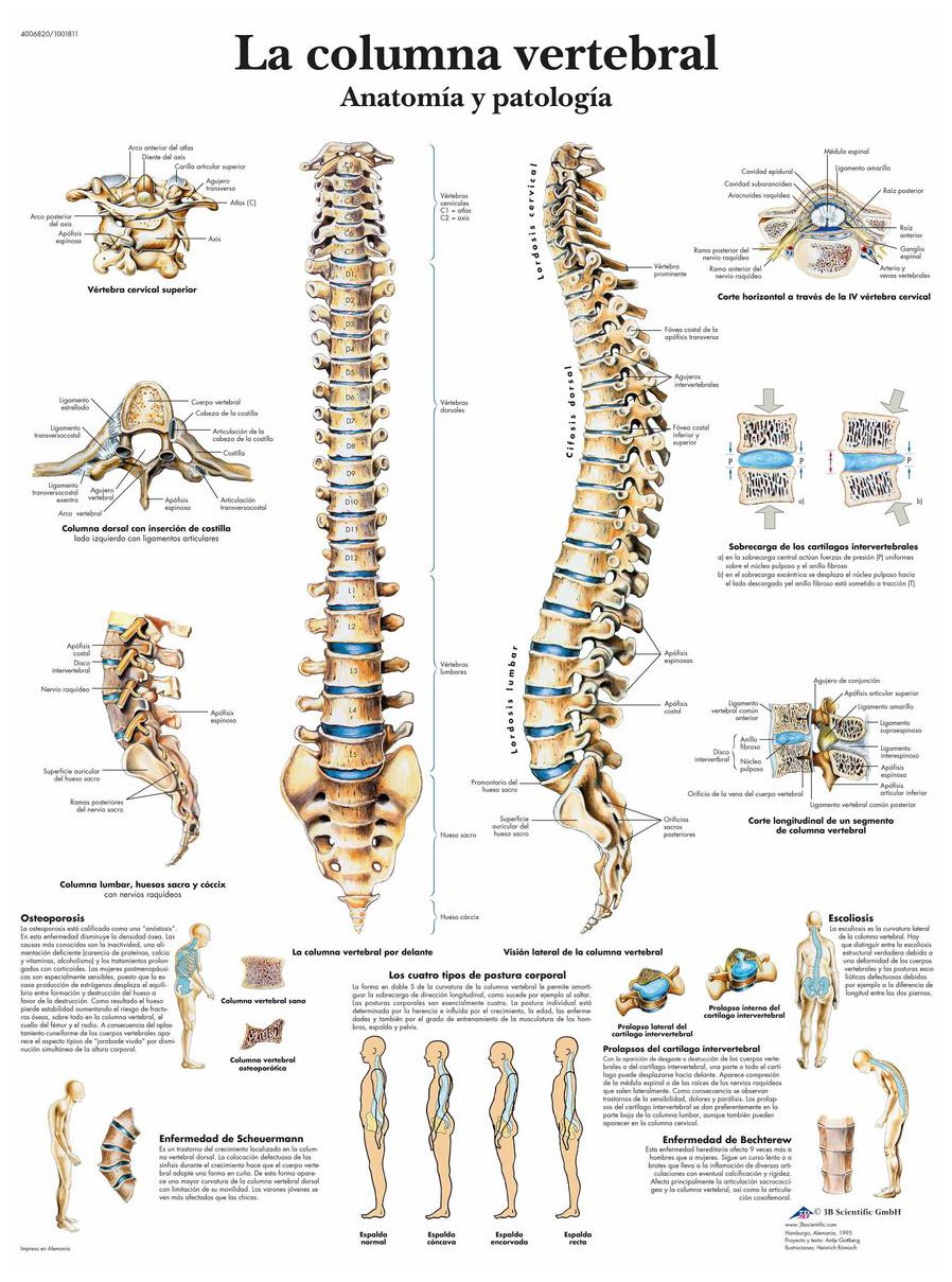 3b-scientific-lehrtafel-wirbels-ule-anatomie-und-pathologie-papier-50x67-cm image 2