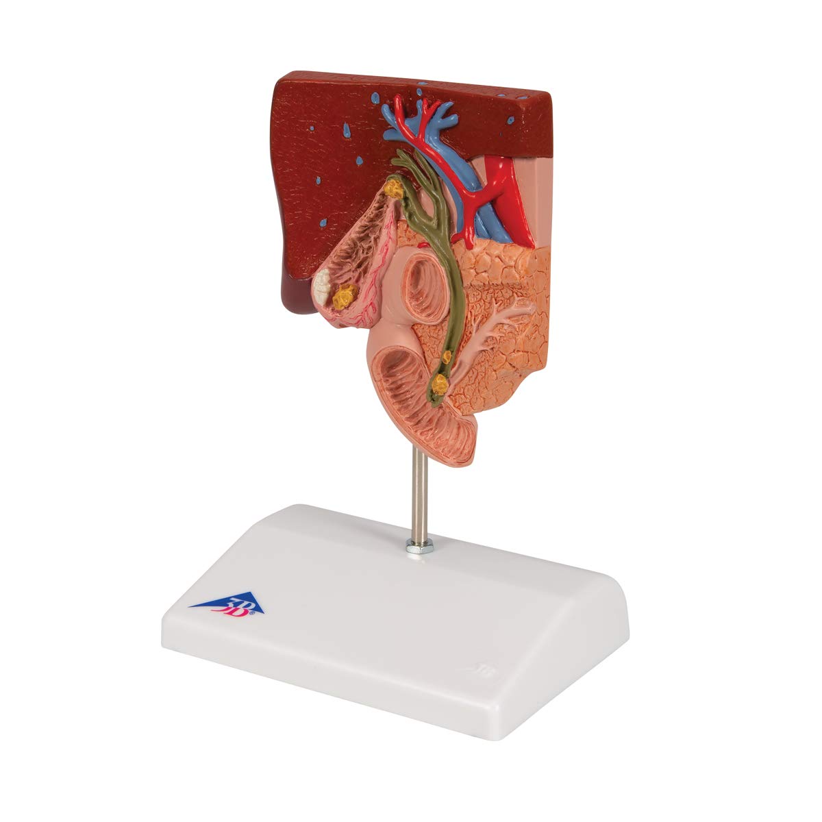 3b-scientific-gallenstein-modell-gallenblasenanatomie-mit-gallensteinbildungen-a image 5