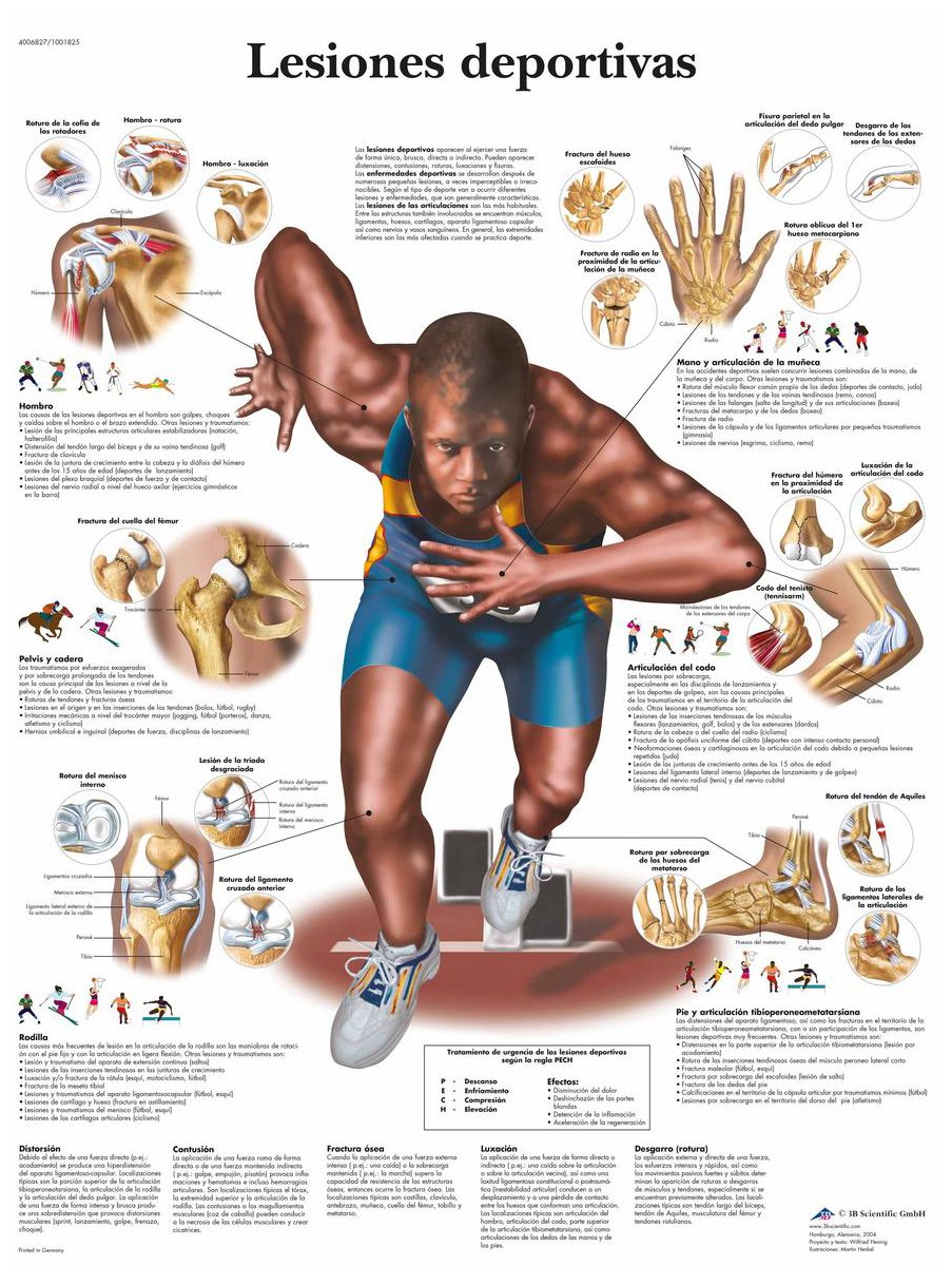 3b-scientific-sportverletzungen-tafel-laminiertes-anatomieposter-50x67-cm image 2